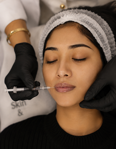 Dermal Fillers Treatments