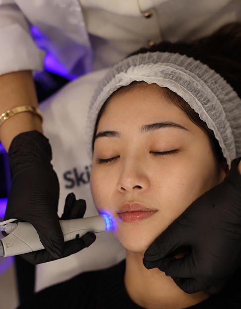 Hydrafacials