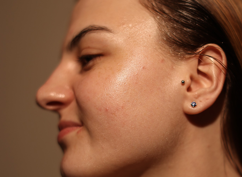 obagi facial